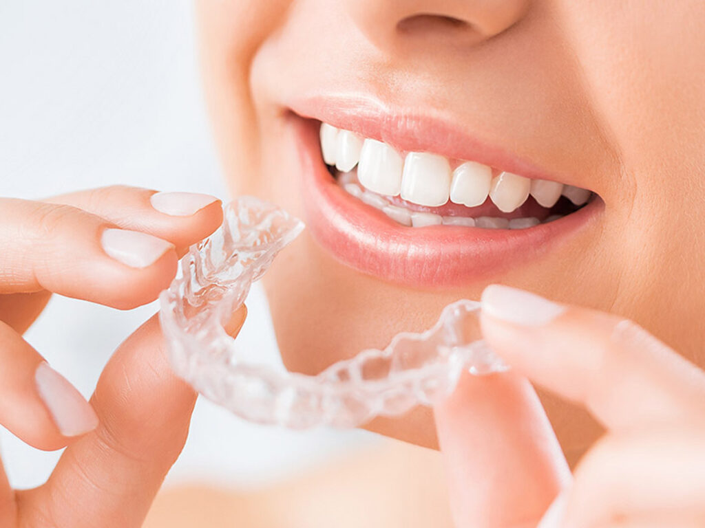 invisalign
