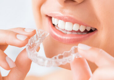 invisalign